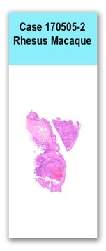 Case 170502-2