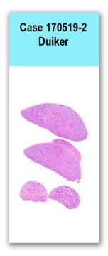 Case 170519-2