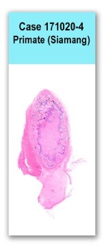 Case 171020-4