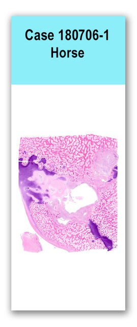 Case 180706-1
