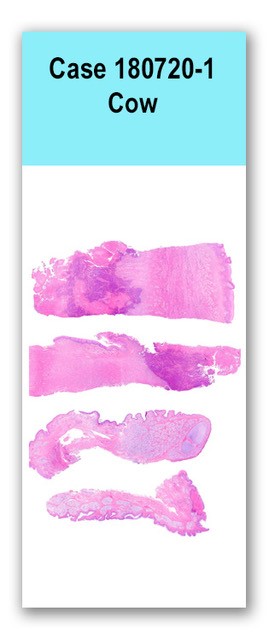 Case 180720-1