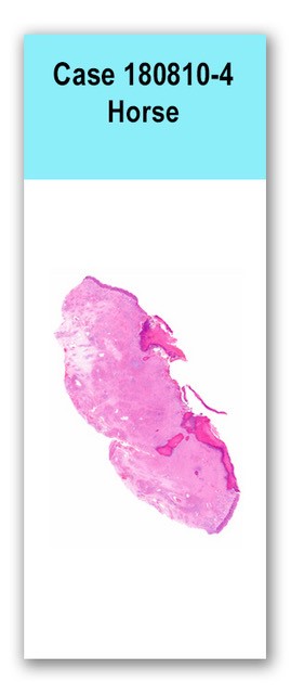 Case 180810-4