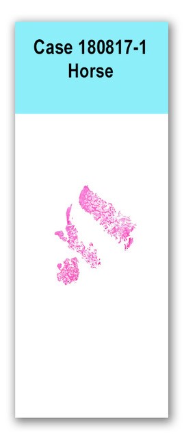 Case 180817-1