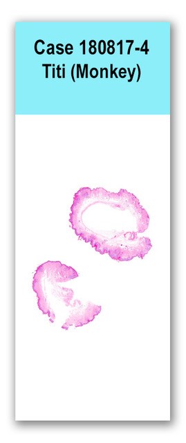 Case 180817-4